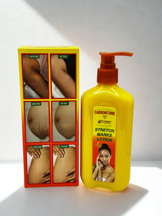 lotion contre les vergetures