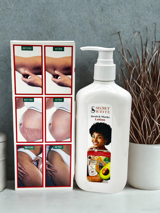 lotion contre les vergetures